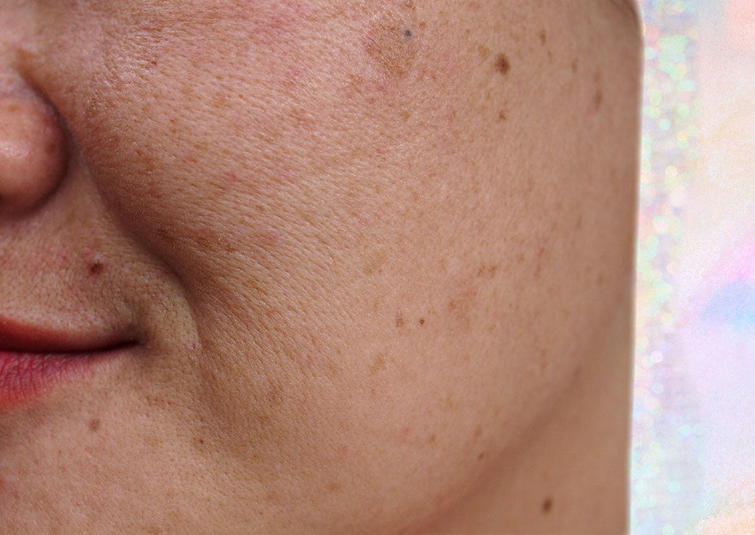 Derms Say These Are THE BEST Ingredients To Fade Dark Spots - A1