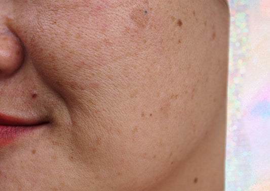 Derms Say These Are THE BEST Ingredients To Fade Dark Spots - A1