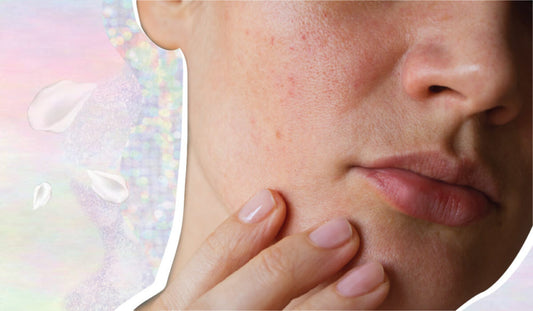 How To Take Care Of Your Skin During And After Chemotherapy - A1