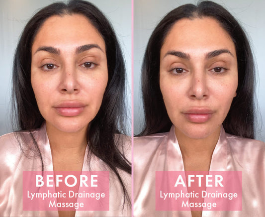 Lymphatic Drainage Will Sculpt & Tone Your Skin (For Free) - A1