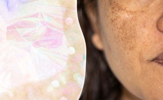 An Expert's Guide To Treating Post-Summer Hyperpigmentation - A1