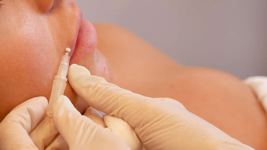 Forget Lip Fillers, Lip Threads Are WAY Better - A1