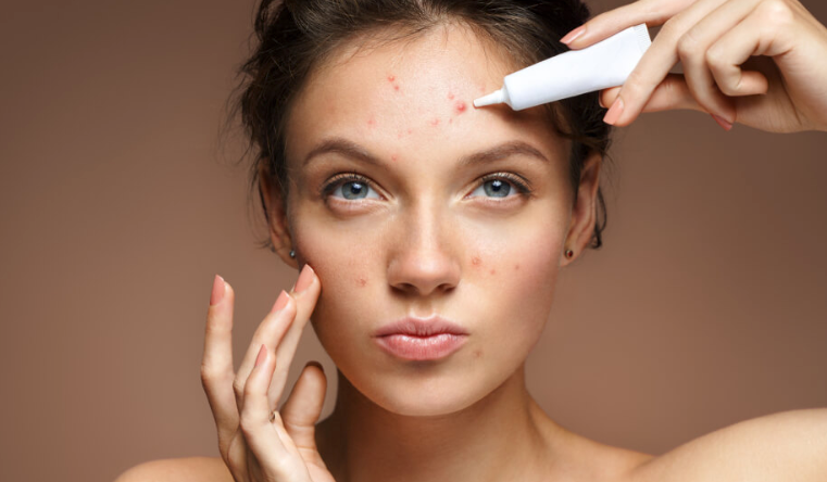 If You HAVE To Pop A Pimple, This Is How You Should Do It - A1