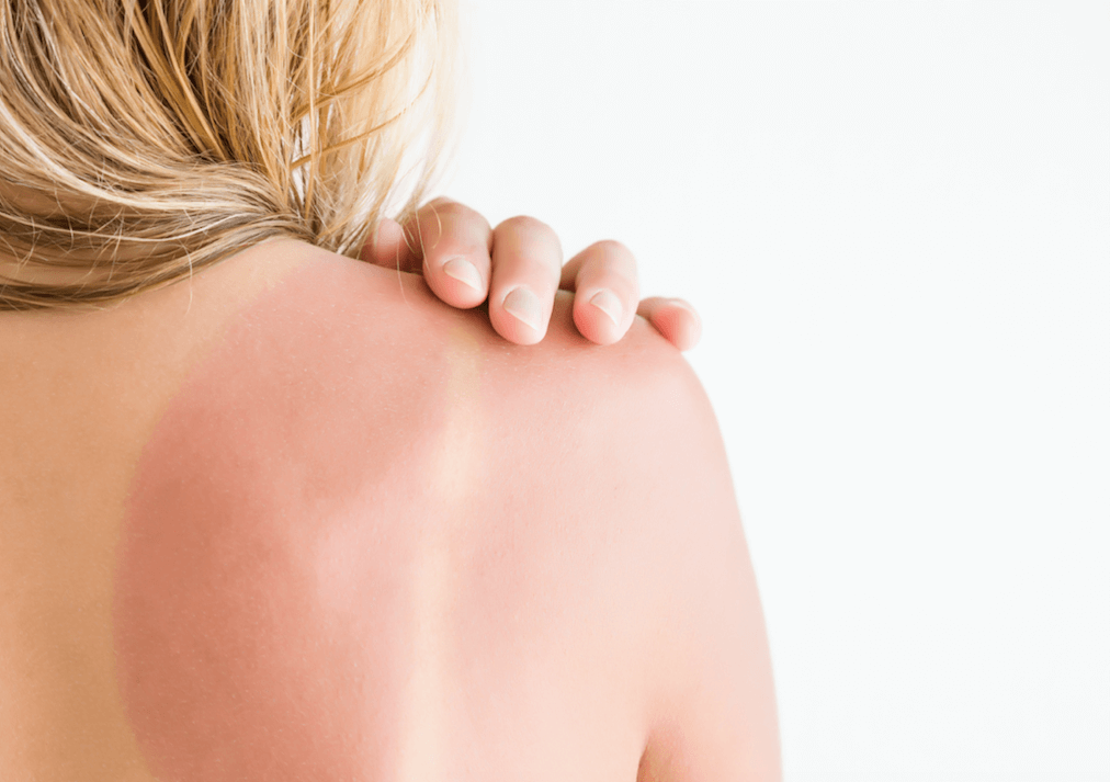 Don’t Go In The Sun Until You’ve Read This SPF Guide - A1