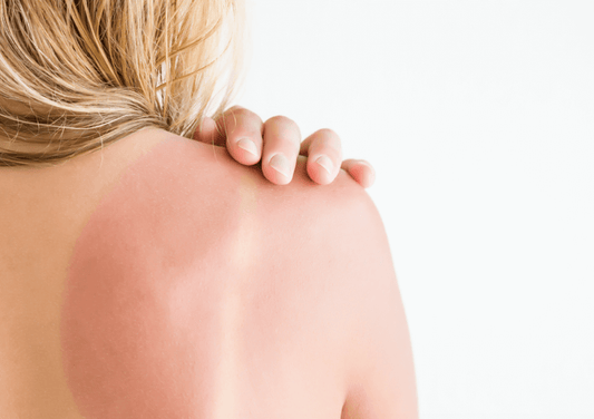 Don’t Go In The Sun Until You’ve Read This SPF Guide - A1