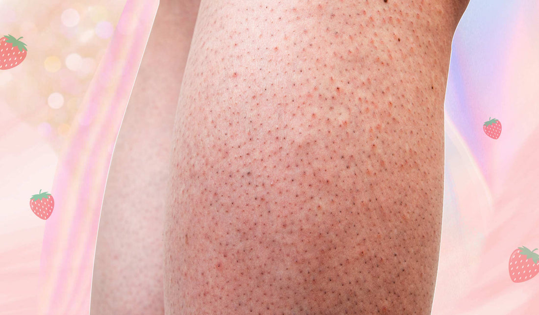 Strawberry Legs: What Those Tiny Dots Are & How To Get Rid Of Them - A1