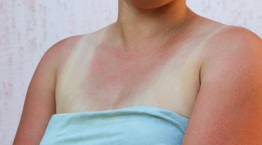 If You Believe These SPF Myths, You're In BIG Trouble - A1