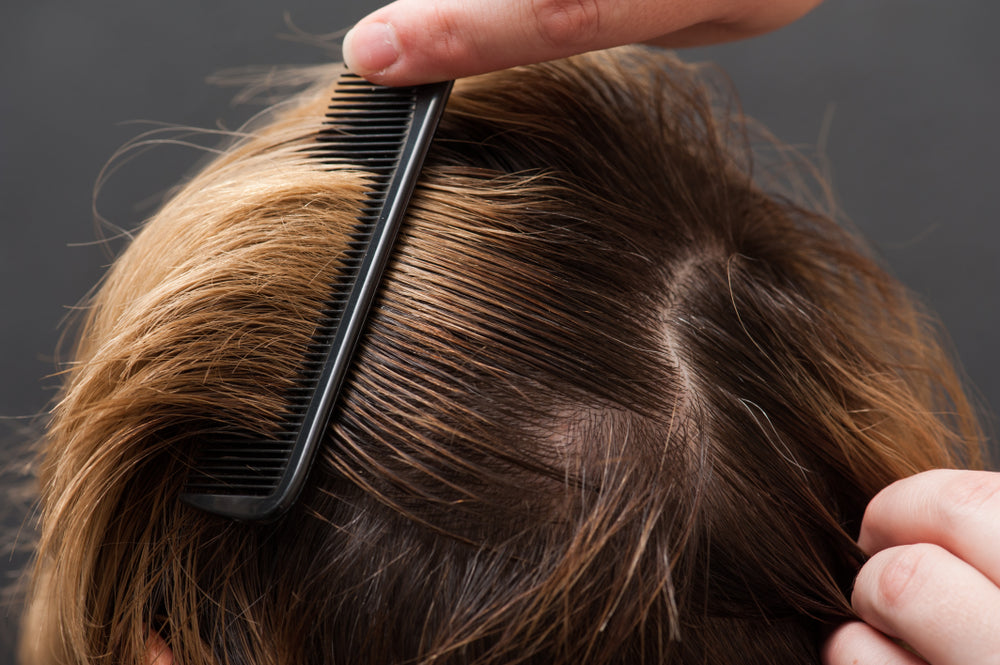 5 Things You Need To Avoid If You Don’t Want Greasy Locks - A1