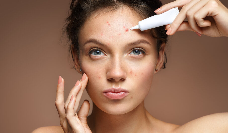 The 2 Best Acne Treatments For Getting Rid Of Pimples - A1