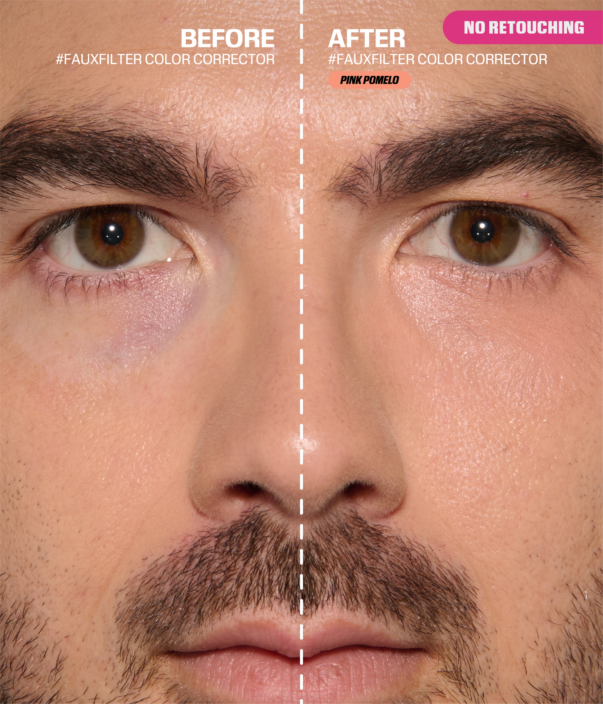 #FAUXFILTER Under Eye Color Corrector - Pink Pomelo - B&A