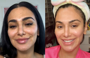 Huda Skin Journey